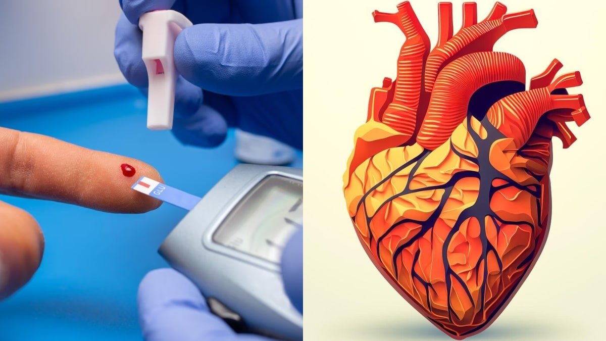 Integrated Management of Diabetes and Heart Disease